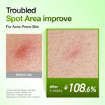Anua Azelaic Acid 10 Hyaluron Redness