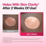 Anua Niacinamide 10