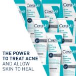 CeraVe Acne Foaming Cream Cleanser, 4% Benzoyl Peroxide Face Wash With Hyaluronic Acid, Niacinamide & Ceramides, Gentle Daily Acne Treatment For Face, 5 Fl Oz/150 ml - Image 2