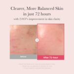 medicube TXA&Niacinamide